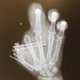 Illustration for article titled Jason Pierre-Paul Shares X-Ray Of His Hand